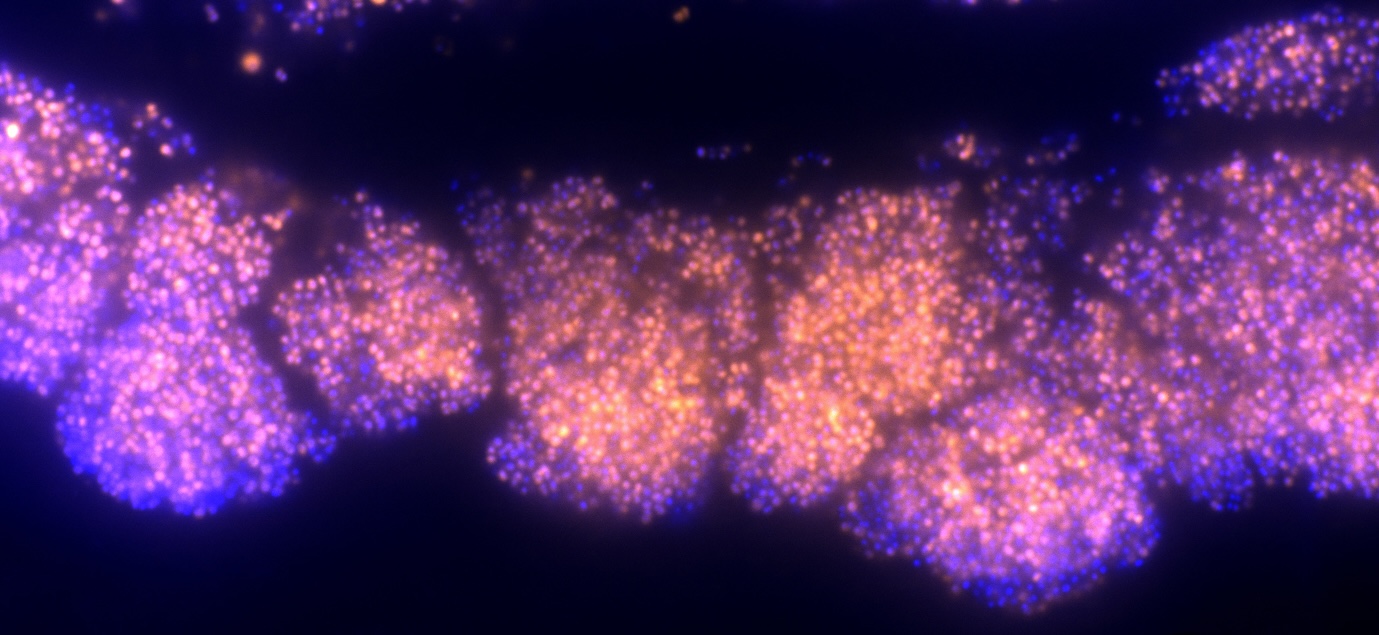 FISH microscopy background